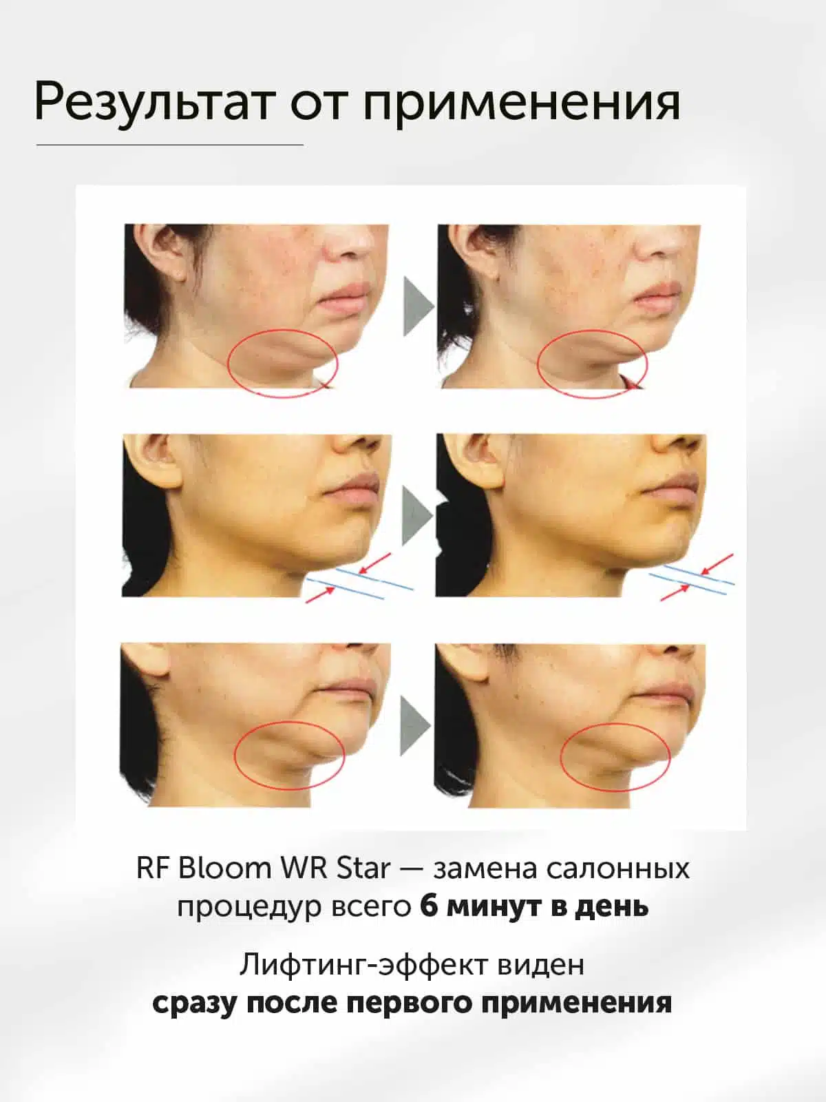 Бет терісін терең көтеруге және әжімдерді кетіруге арналған YA-MAN RF Bloom WR Star премиум массажері - кескін 7