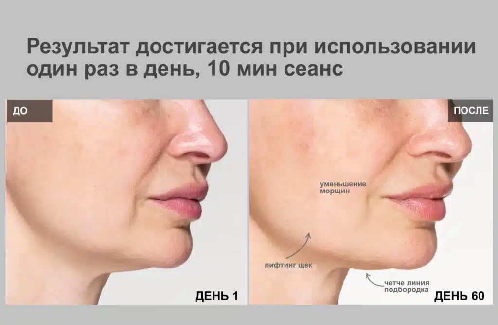 Терең EMS көтеру функциясы бар YA-MAN Medilift Plus премиум бет маскасы - кескін 2