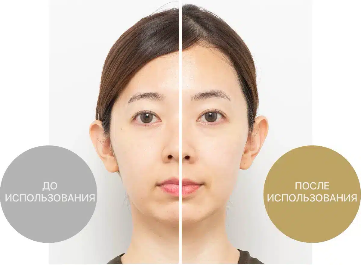 Hyper Face Lift Brush жаңа көп функционалды қондырмасы бар кәсіби лифтинг күтімі. - кескін 6