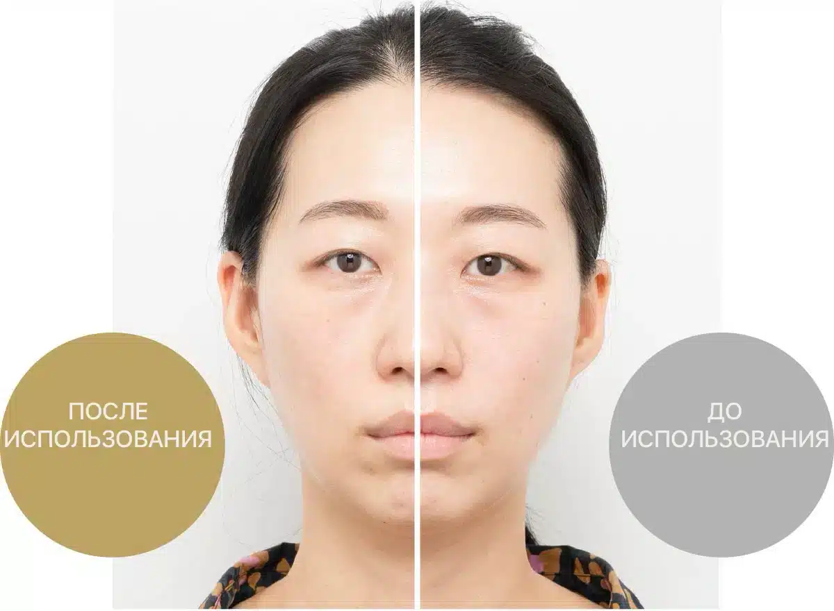 Hyper Face Lift Brush жаңа көп функционалды қондырмасы бар кәсіби лифтинг күтімі. - кескін 7